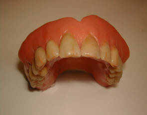 prothese dentaire laboratoire dentaire Franois Dunand